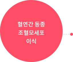 혈연간 동종 조혈모세포 이식