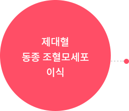 제대혈 동종 조혈모세포 이식